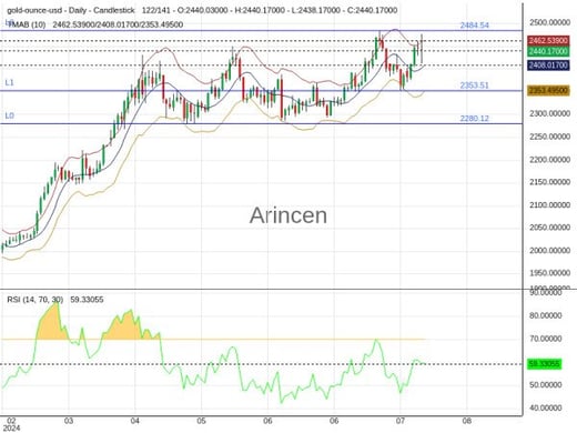 XAUUSD Chart