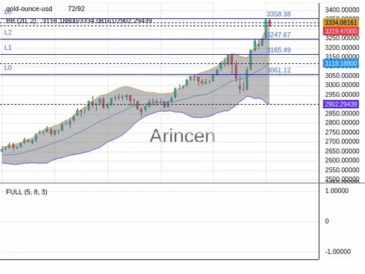 XAUUSD Chart