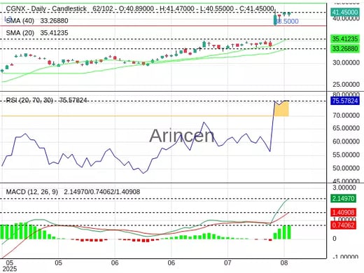 CGNX Chart
